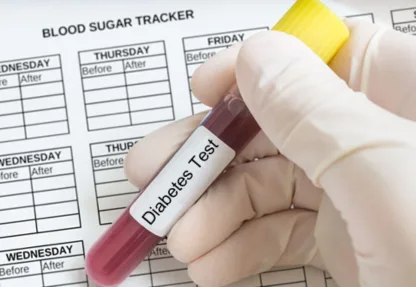 sugartest